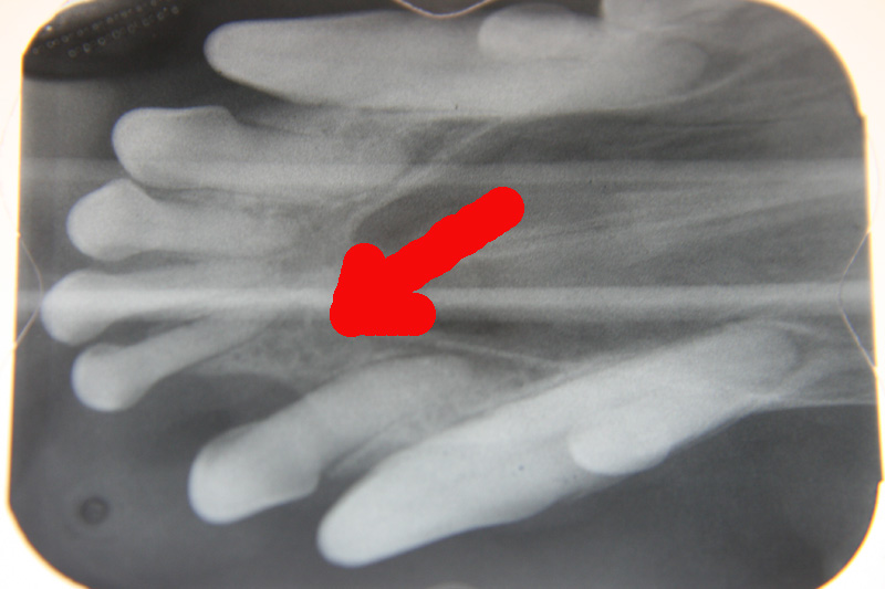 Missing incisor dental radiograph