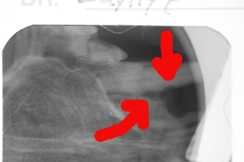 Feline reorptive lesion