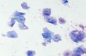 Canine vaginal cytology