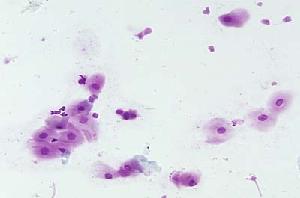 Canine vaginal cytology