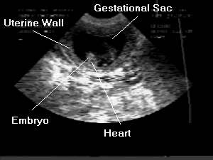 Pregnant dog sonogram